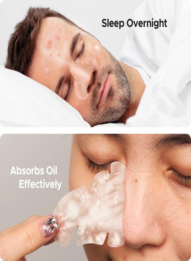 تي كيه تي كيه لصقات الأنف الهيدروكولويدية من TKTK، شرائط مسام الأنف XL 91 × 48 مم، لصقات حب الشباب الكبيرة الهيدروكولويدية للوجه، تغطي عيوب البثور وتمتص الزيوت (مُصممة لتناسب شكل الأنف، شريط، نقاط 5 أحجام 112 قطعة) - Image 4